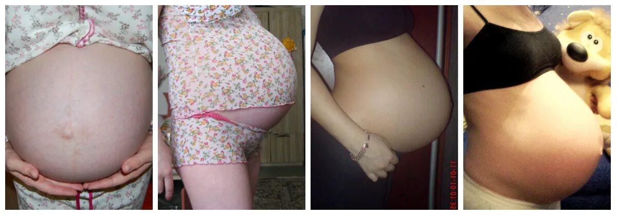37 неделя развития. Живот на 36 неделе. Живот на 37 неделе беременности.
