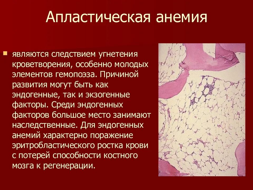 Апластическая анемия это. Для апластической анемии характерно:. апластическая анемия презентация. апластическая анемия характерно. наследственная апластическая анемия.