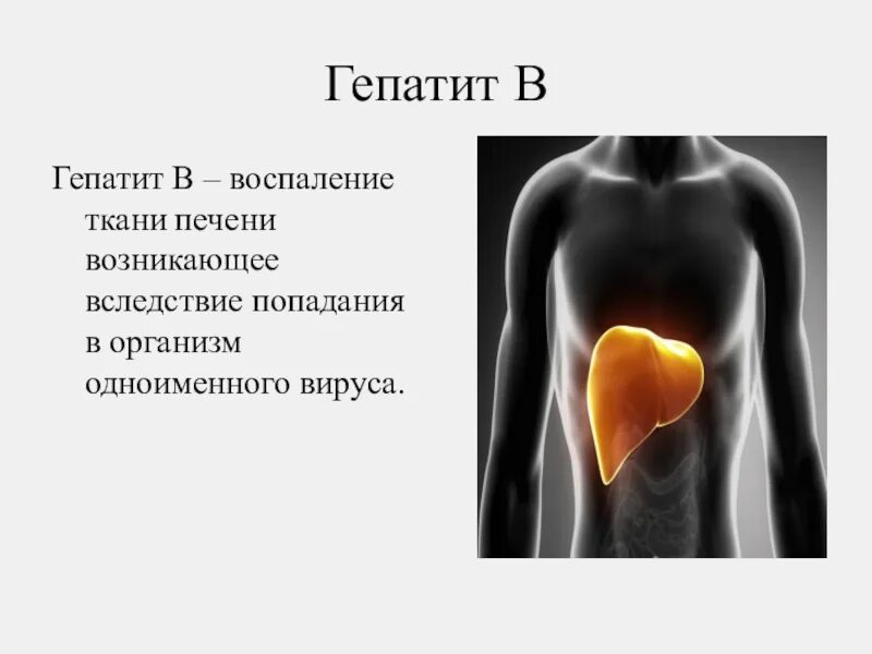 Вирусный гепатит печень.