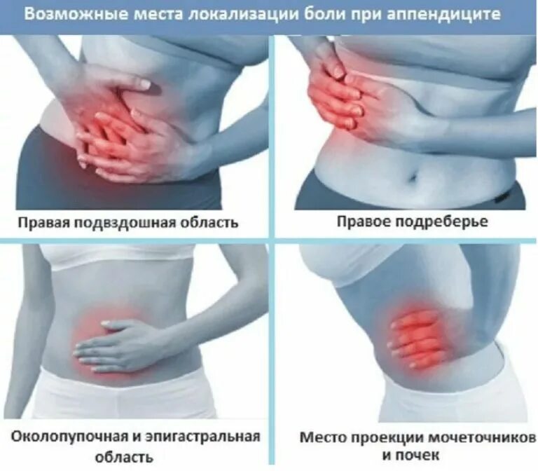 Где находится аппендицит. Локализация боли при аппендиците.