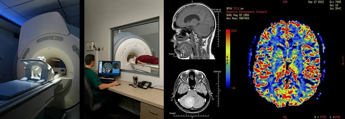 Можно ли кт. Ядерно-магнитный резонанс томография. Ядерно-магнитно-резонансная томография мозга магнитно-резонансная. Магнитно - резонансная томография (ЯМР). Функциональная Магнито-резонансная томография мозга человека.
