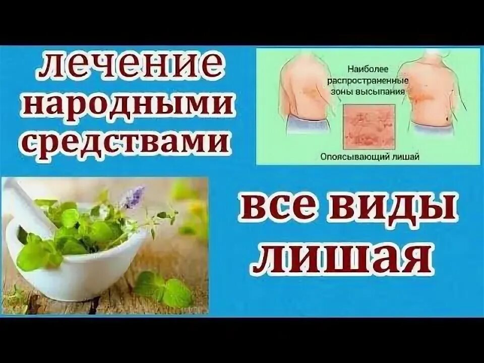 Лишай народные средства. Народные средства от лишая. Народные средства от лишая у человека. Лишай народными методами. Лечение лишая в домашних условиях народными