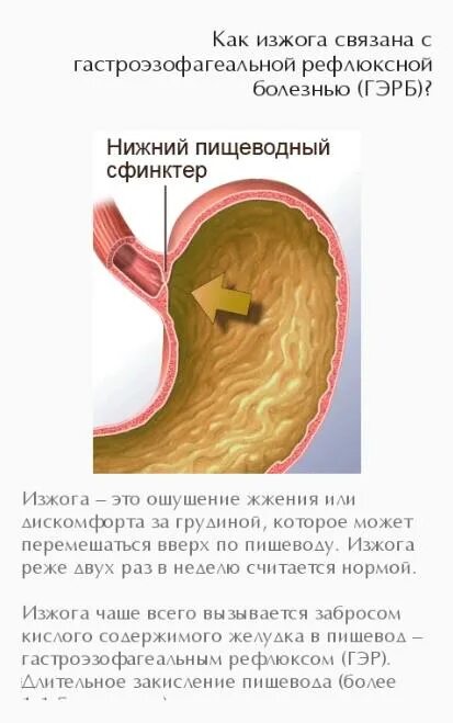 Лен при гэрб. Можно ли в сауну при гэрб. изжога от песочного теста причины. почему от лецитина изжога.