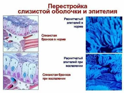 Эпителии верхних дыхательных путей