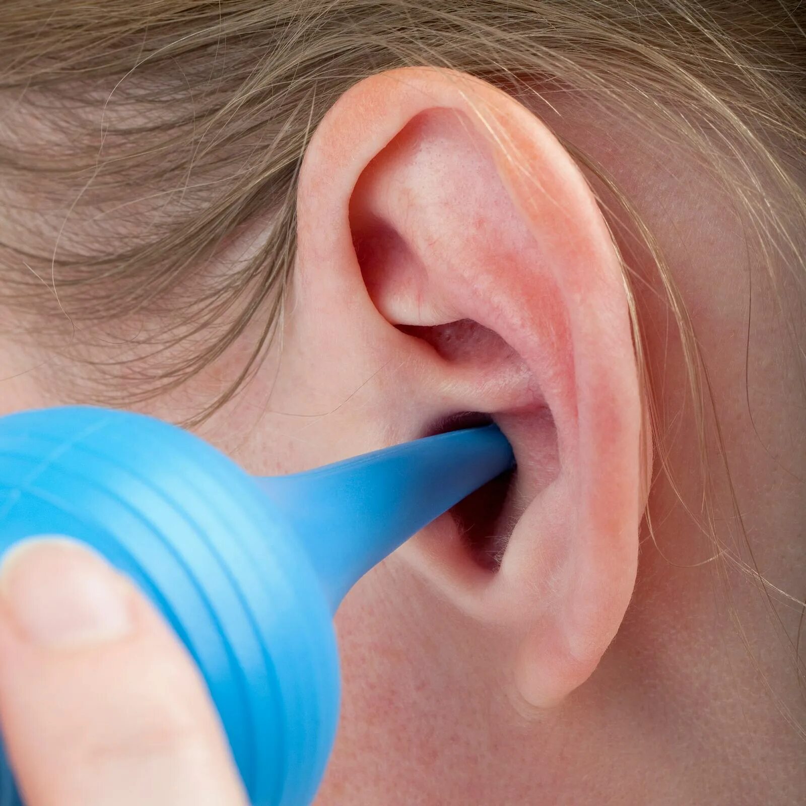 Как промыть уши самому в домашних условиях. Промывание пробки в ухе.
