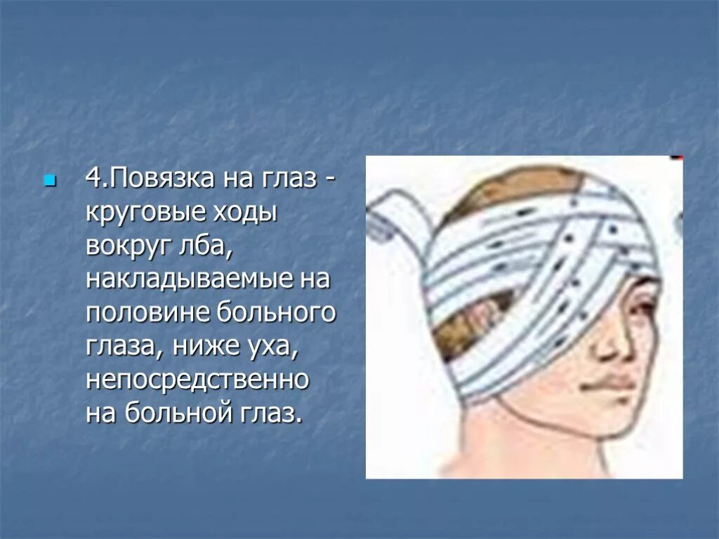 Какой полководец носил повязку на глазу. Повязку на глаза накладывают. Наложить повязку при травме глаза. Повязка на травмированный глаз по ОБЖ. Повязка при ранении глаза.