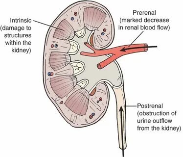 Renal почки