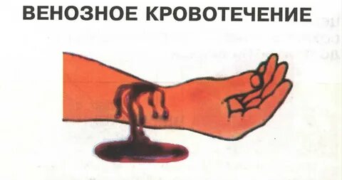 Венозное