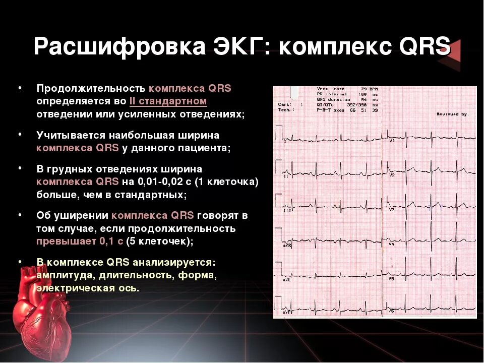 Комплекс QRS на ЭКГ норма. Кардиограмма сердца расшифровка синусовый ритм норма. ЭКГ сердца расшифровка норма и патология. QRS MS на ЭКГ норма.