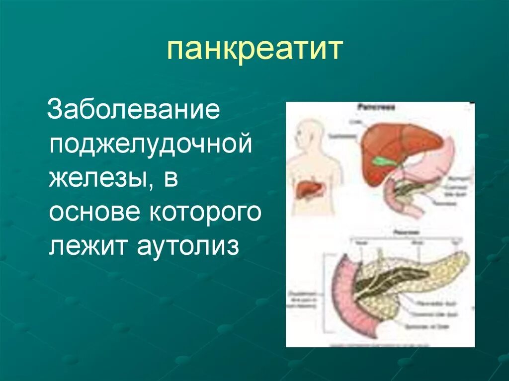 Панкреатит заболевание поджелудочной железы. Патология поджелудочной железы. Заболевания поджелудочной железы презентация. Основы аутолиза поджелудочной железы. Патология панкреатической железы.