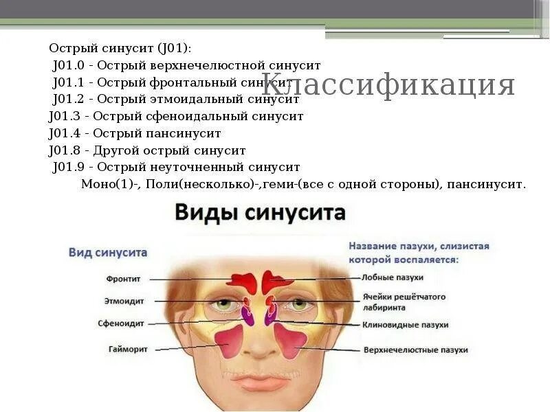 Острый фронтальный синусит симптомы. Острый гайморит клинические рекомендации у взрослых. Симптомы острого верхнечелюстного синусита. Острый синусит клинические рекомендации. Сколько лечат гайморит