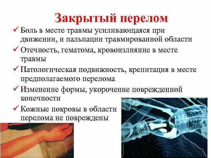Симптом патологической подвижности. Симптом патологической подвижности