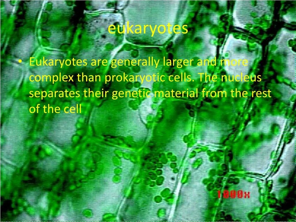 Хлоропласты микроскоп. Красивые живые клетки растений. Вакуоль растительной клетки под микроскопом. Растительная клетка фото. Механическая ткань у элодеи.