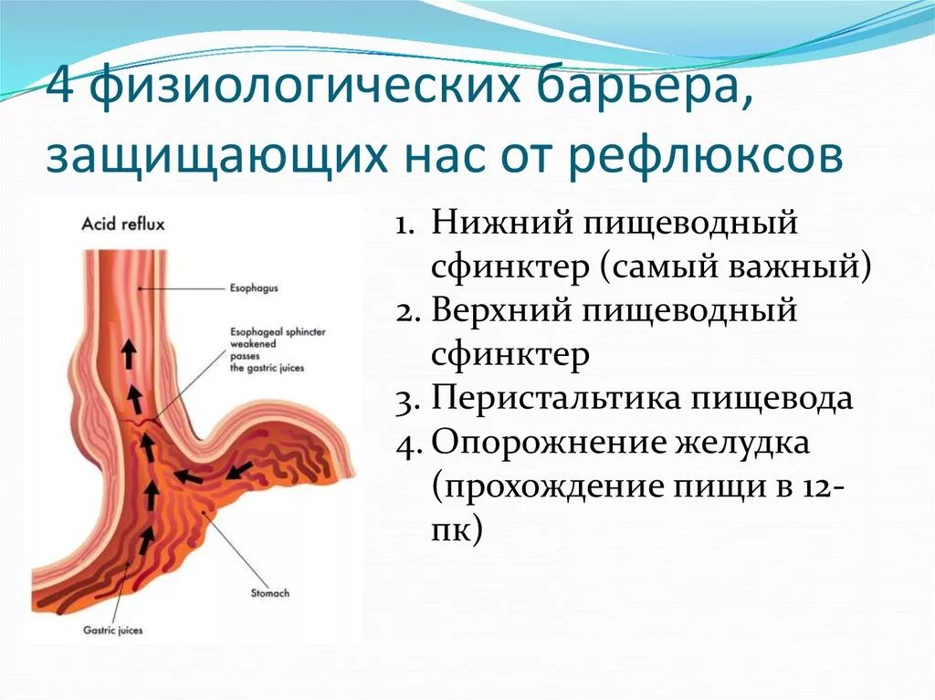 Клапан пищевода и желудка. Ларингофарингеальный рефлюкс. Ларингофарингеальный рефлюкс патогенез. Верхний пищеводный сфинктер. Пищеводно желудочный сфинктер.