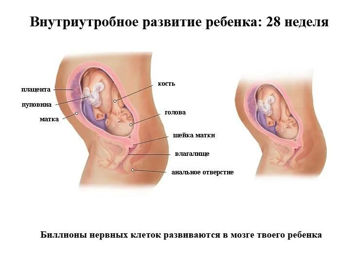 28 акушерских недель. Положение ребенка на 29 неделе беременности. Расположение плода на 20 неделе. Расположение плода на 27 неделе беременности. Положение малыша в животе на 29 неделе беременности.