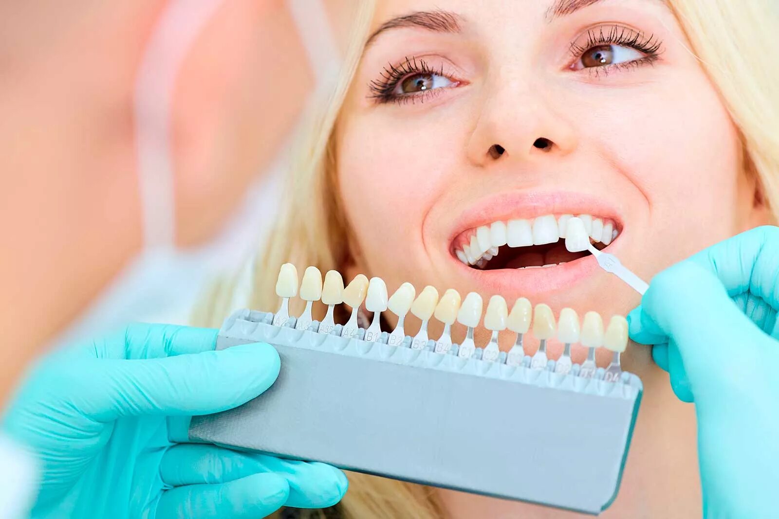 Отбеливание. Отбеливание зубов в стоматологии. Здоровые зубы. Ортопедическая стоматология.