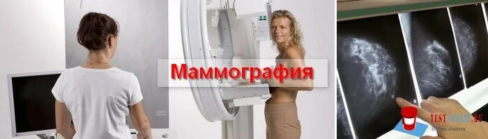 Маммография на госуслугах. Маммография. Маммография опасна для здоровья. Маммография молочных желез. Ультразвуковая маммография.