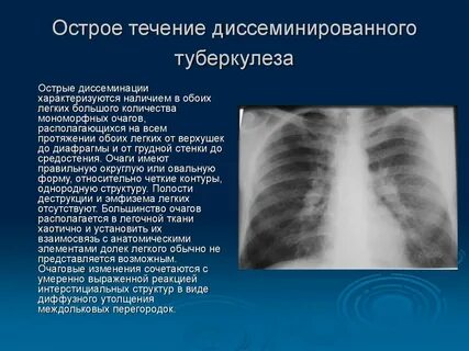 Туберкулезно легочное отделение