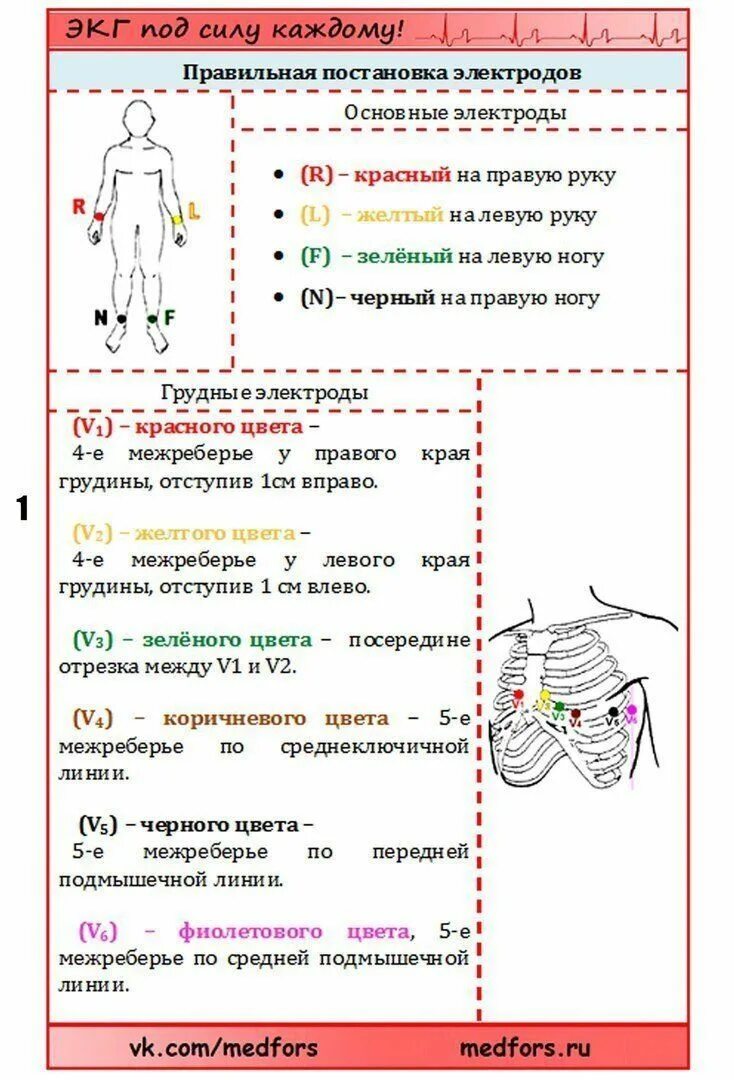 Дефибрилляция: история возникновения, механизм действия, современные рекомендаци