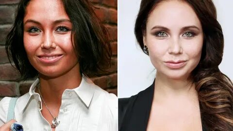 Утяшева до пластики