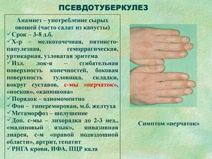 Иерсиниозная инфекция