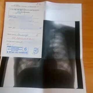 Флюорография казань