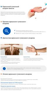 Синдром ладони