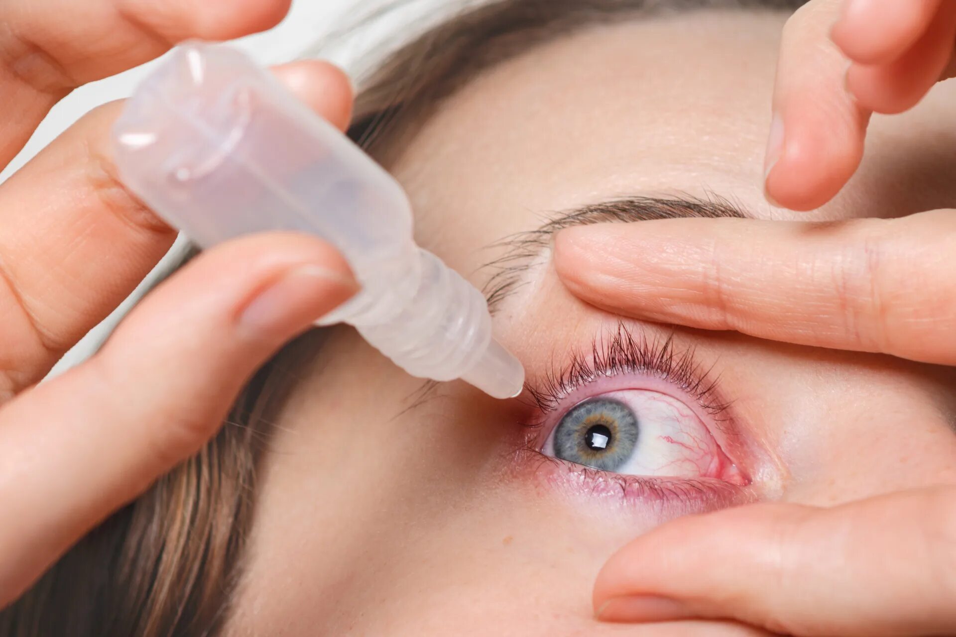 Дур глаз. Офтальмогерпес кератит. Конъюнктивит закапывание глаз.