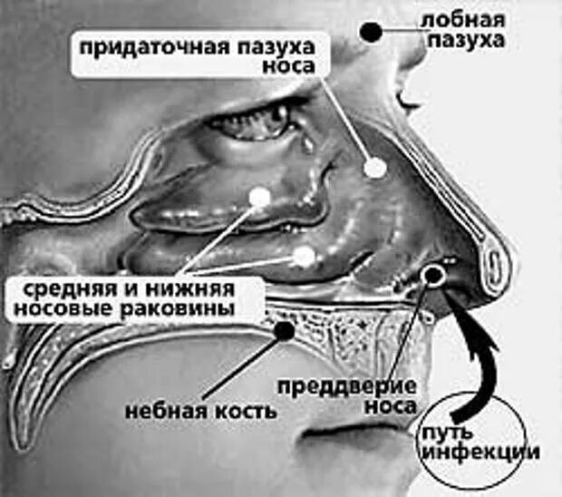 Почему сопли пахнут. Образование слизи в носовой полости. Строение носа при заложенности. Механизм образования соплей.