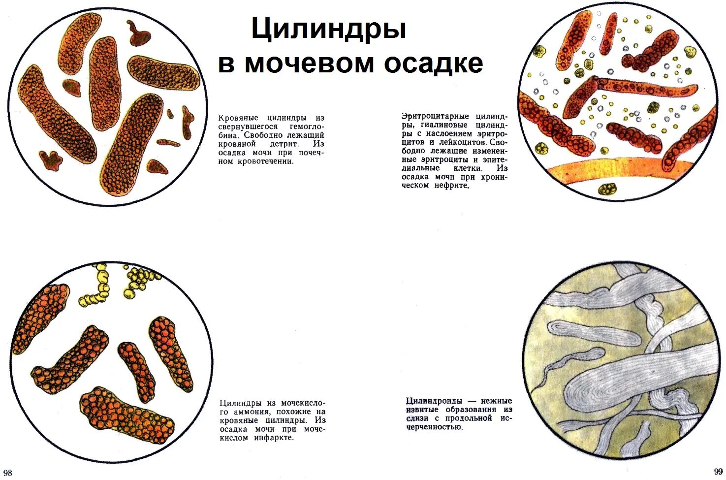 Моче слизь эритроциты