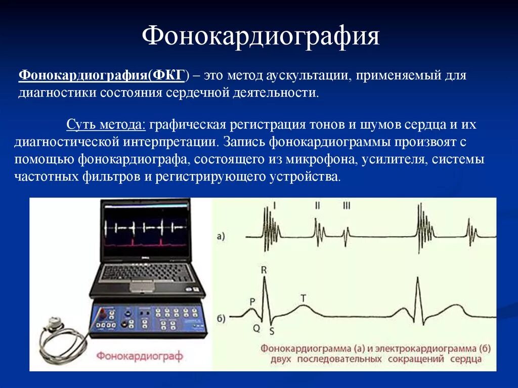 Метод исследования ФКГ. Методы исследования тонов сердца аускультация фонокардиография. Методы фонокардиографии. Фонокардиография сердца.