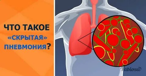 Пневмония симптомы как распознать