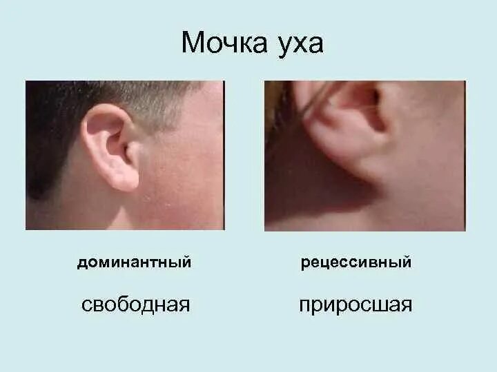 Рецессивный признак уха. Таблица доминантных и рецессивных признаков. Доминантные и рецессивные признаки. Рецессивный признак уха. Рецессивный признак уха.