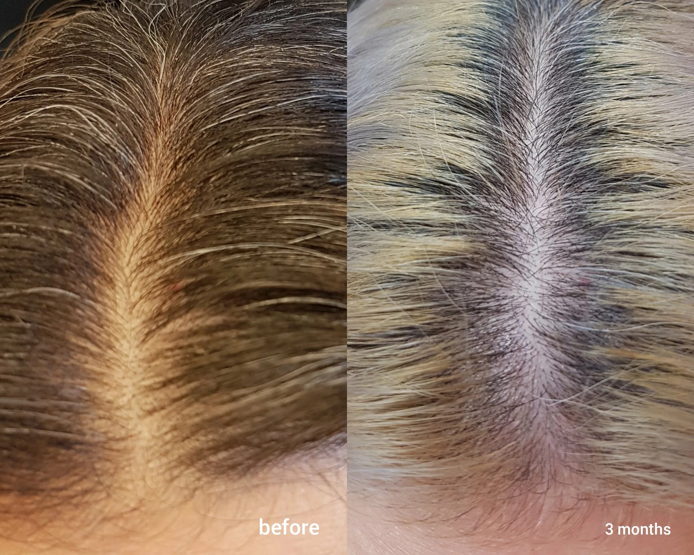 Hair Peptide мезотерапия. Hair x DNA Peptide мезотерапия. Хайр х мезотерапия для волос. Hair x мезотерапия волос.