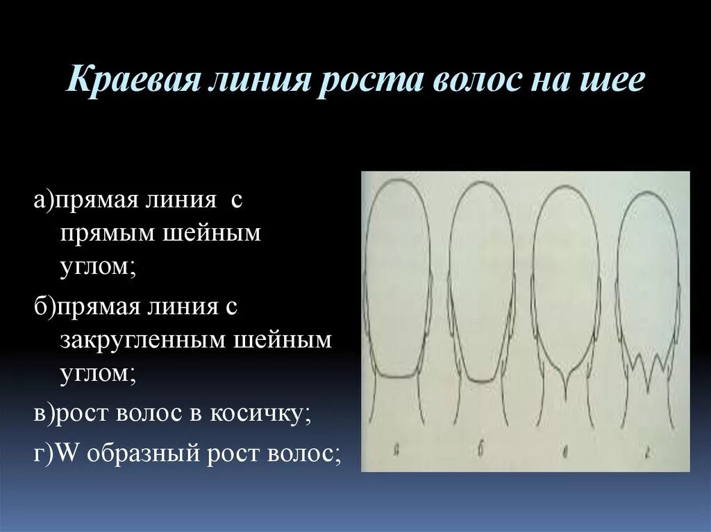 Краевая линия роста волос. Краевые линии роста волос на шее. Типы линии роста волос. Краевая линия роста волос схема.