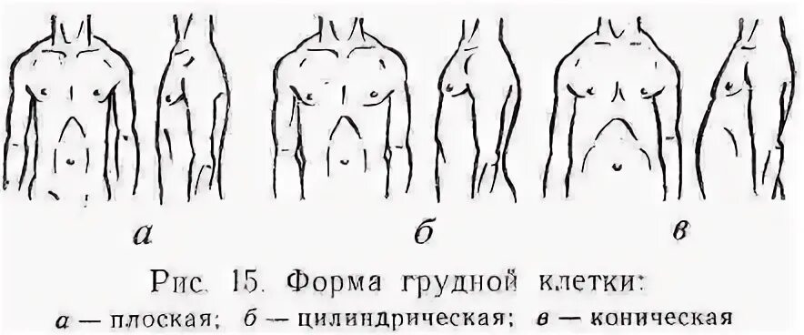 Для астенического типа телосложения эпигастральный угол. Коническая форма грудной. Астенический нормостенический гиперстенический тип грудной клетки. Патологические формы грудной клетки пропедевтика. Коническая форма грудной.