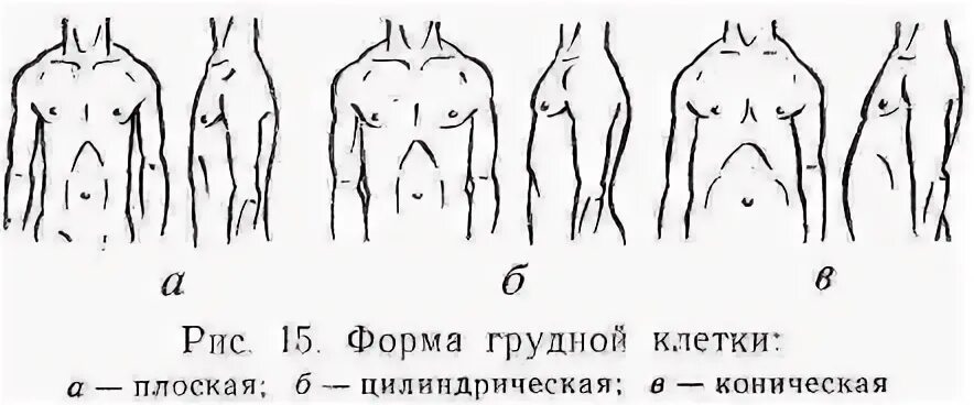 Форма грудной клетки у астеников. Формы грудной клетки коническая цилиндрическая уплощённая. Нормостенический Тип грудной клетки. Нормальные формы грудной клетки пропедевтика. Грудная клетка у ребенка норма