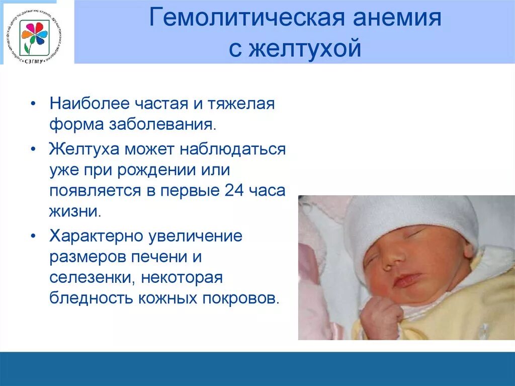 Анемия у грудничка. Серповидноклеточная анемия гемолитическая желтуха. гемолитическая анемия у детей. желтуха при гемолитической анемии. гемолитическая анемия новорожденного.