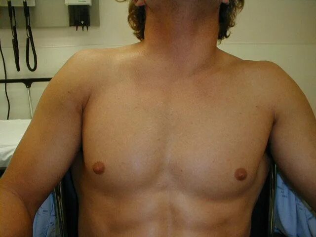 Невралгия грудной клетки. Греет грудную клетку. Грелка на грудную клетку при бронхите. Греет грудную клетку. Греет грудную клетку.