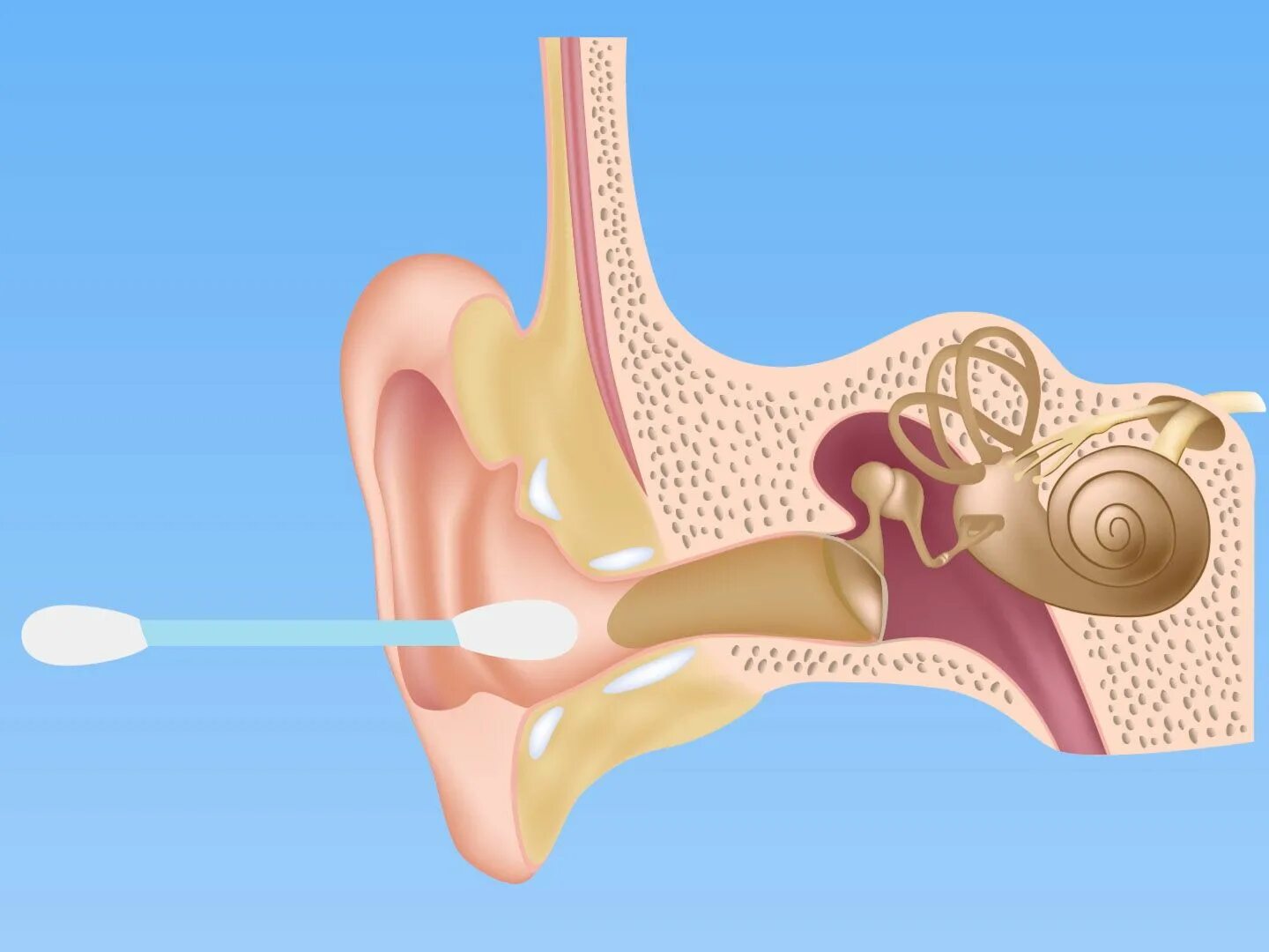 Clean ear. Ушная барабанная перепонка. Перфорация барабанной перепонки. Барабанная перепонка отит.