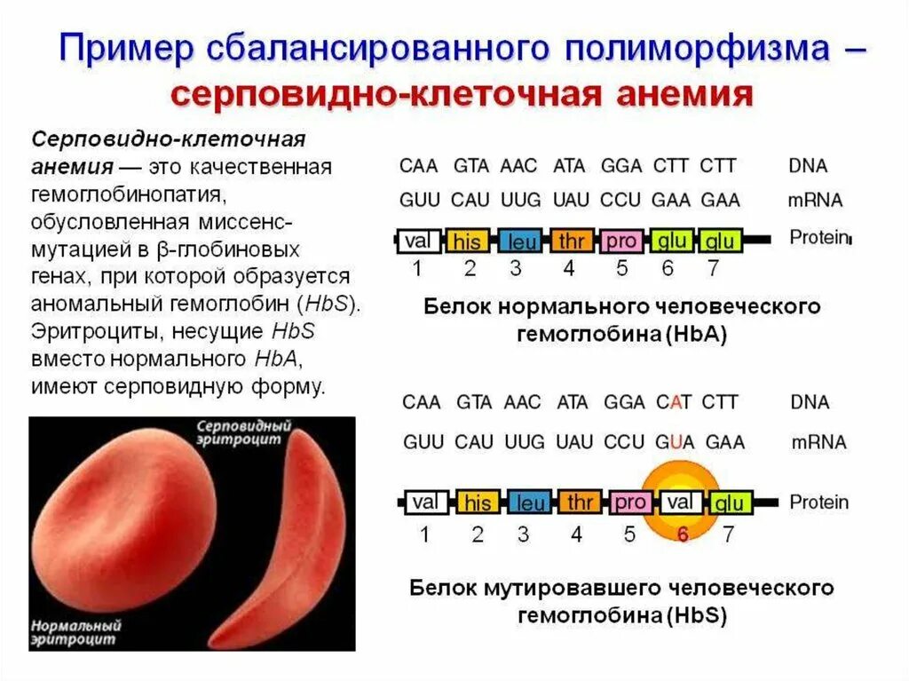 Серповидноклеточная анемия формы. Строение гемоглобина при серповидноклеточной анемии. Серповидноклеточная анемия миссенс мутация. Структура гемоглобина при серповидноклеточной анемии. Серповидноклеточная анемия это пример мутации.
