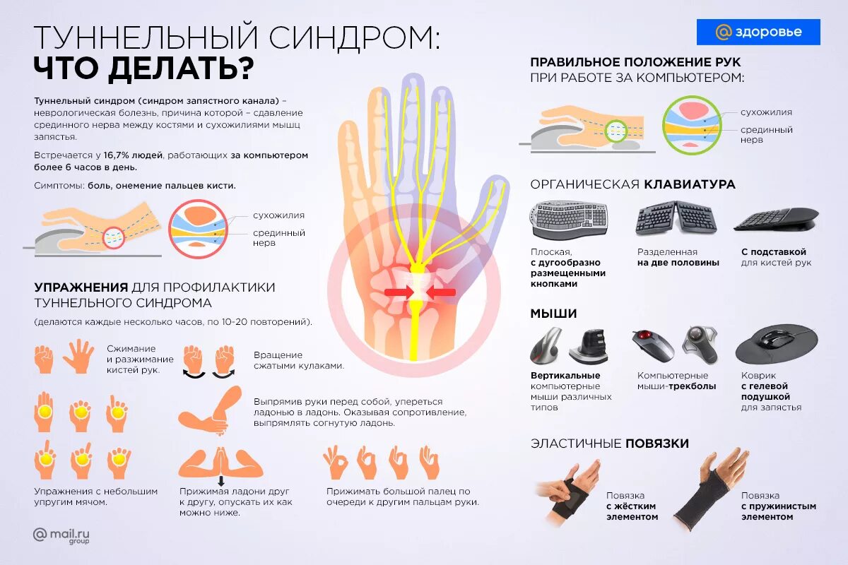 Немеют колени причины у мужчин. Немеет кисть правой руки причины. Симптомы туннельного синдрома запястного канала. Туннельный синдром запястья кисти немеет ладонь. Туннельный синдром запястья кисти руки симптомы.