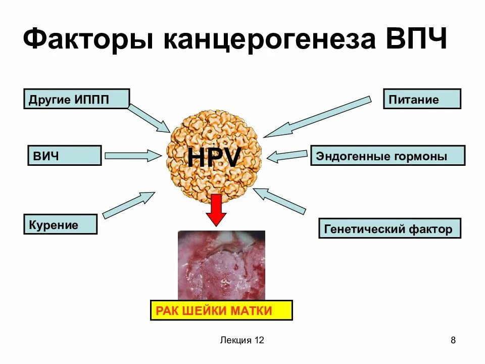 Вирус рака шейки матки. Факторы риска ВПЧ инфекции. Факторы риска инфицирования ВПЧ. Факторы канцерогенеза. Факторы развития папилломавирусной инфекции.