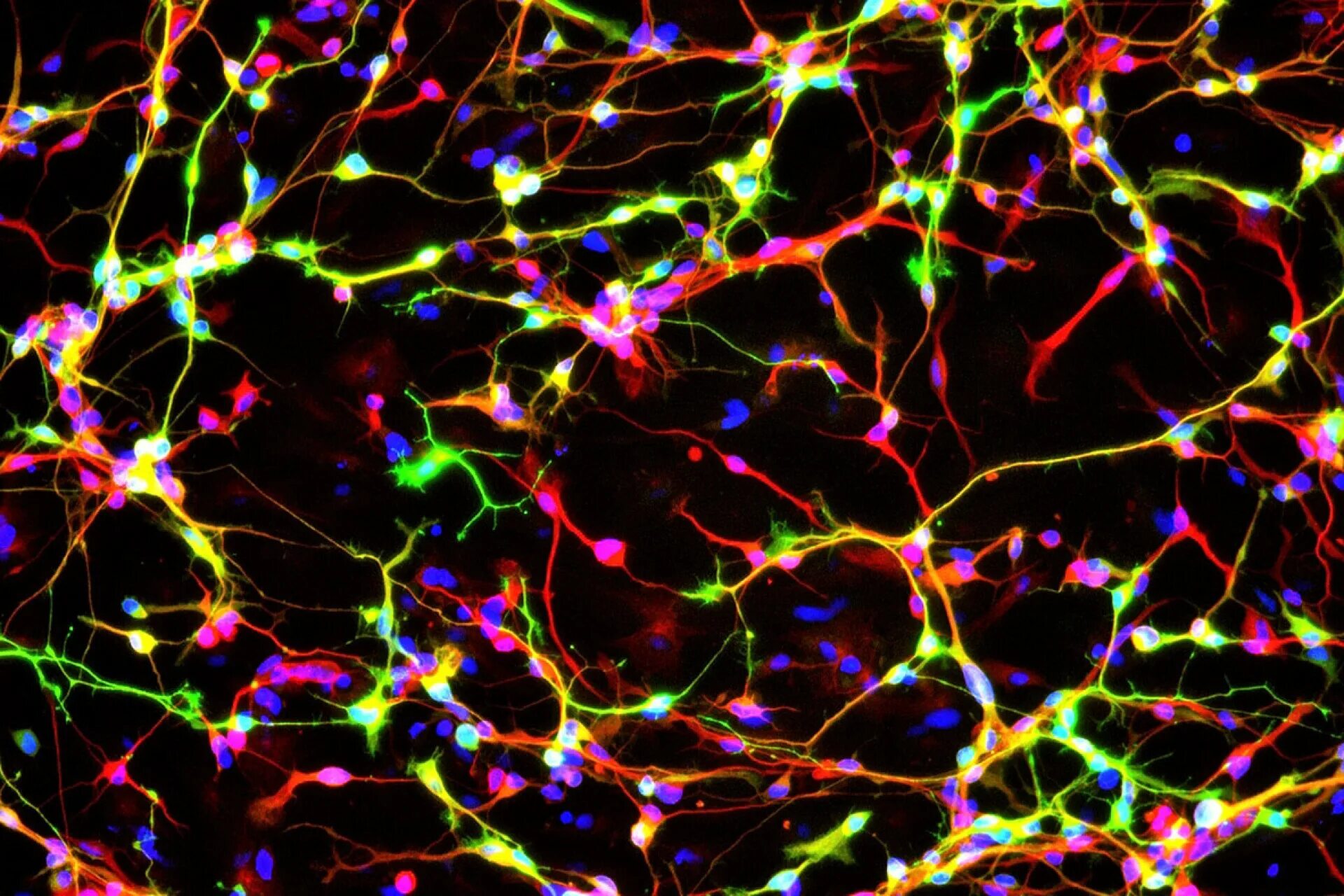 Нейроны мозга. Нейронная сеть и генетика. Мозг нейросеть. Неииронка.