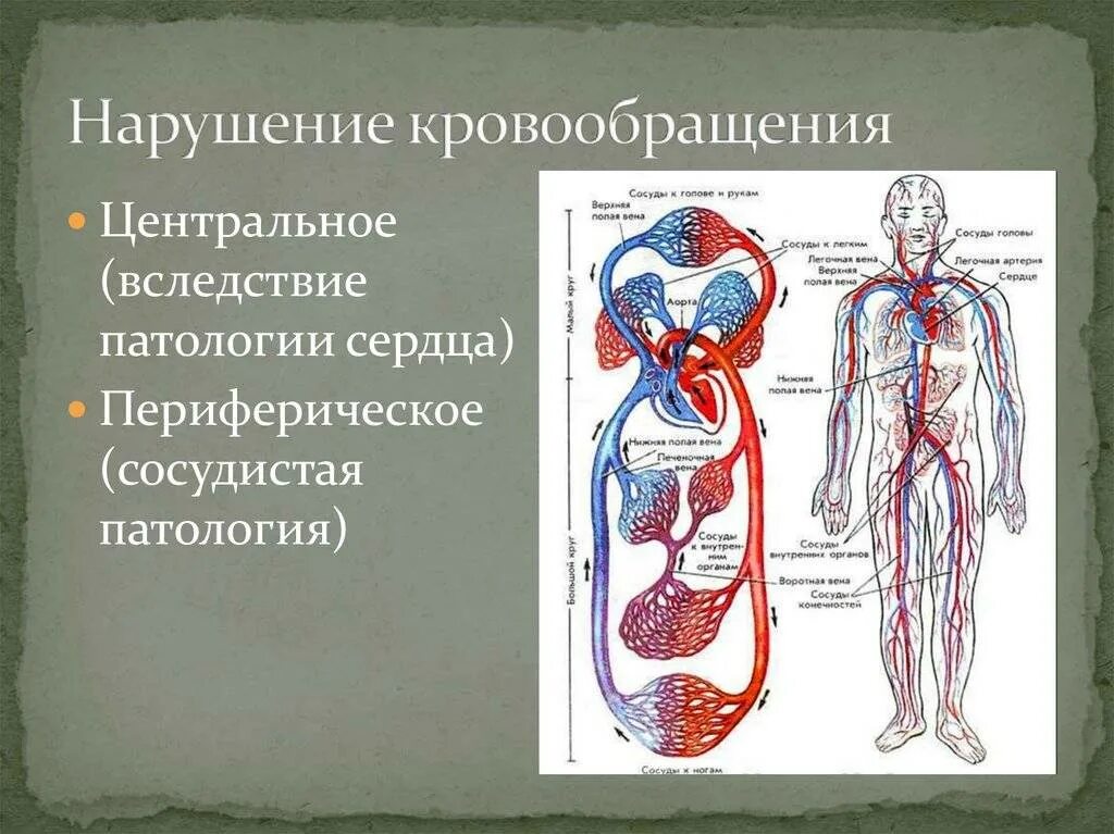 Периферическая система кровообращения схема. Нарушение кровообращения. Патология кровообращения. Нарушение системы кровообращения.