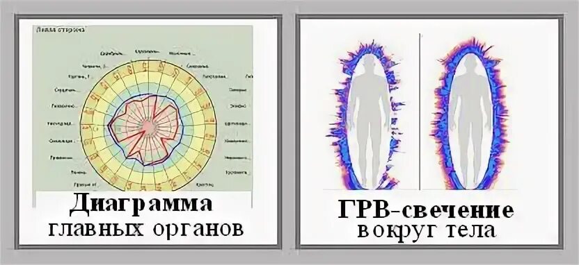 Газоразрядная визуализация