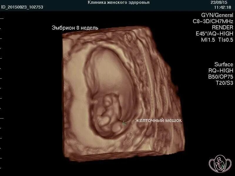 7 недель что происходит с малышом. Эмбрион на 7 неделе беременности УЗИ 3д. Беременность 8 недель фото эмбриона размер. 7 Недель беременности 3д УЗИ.