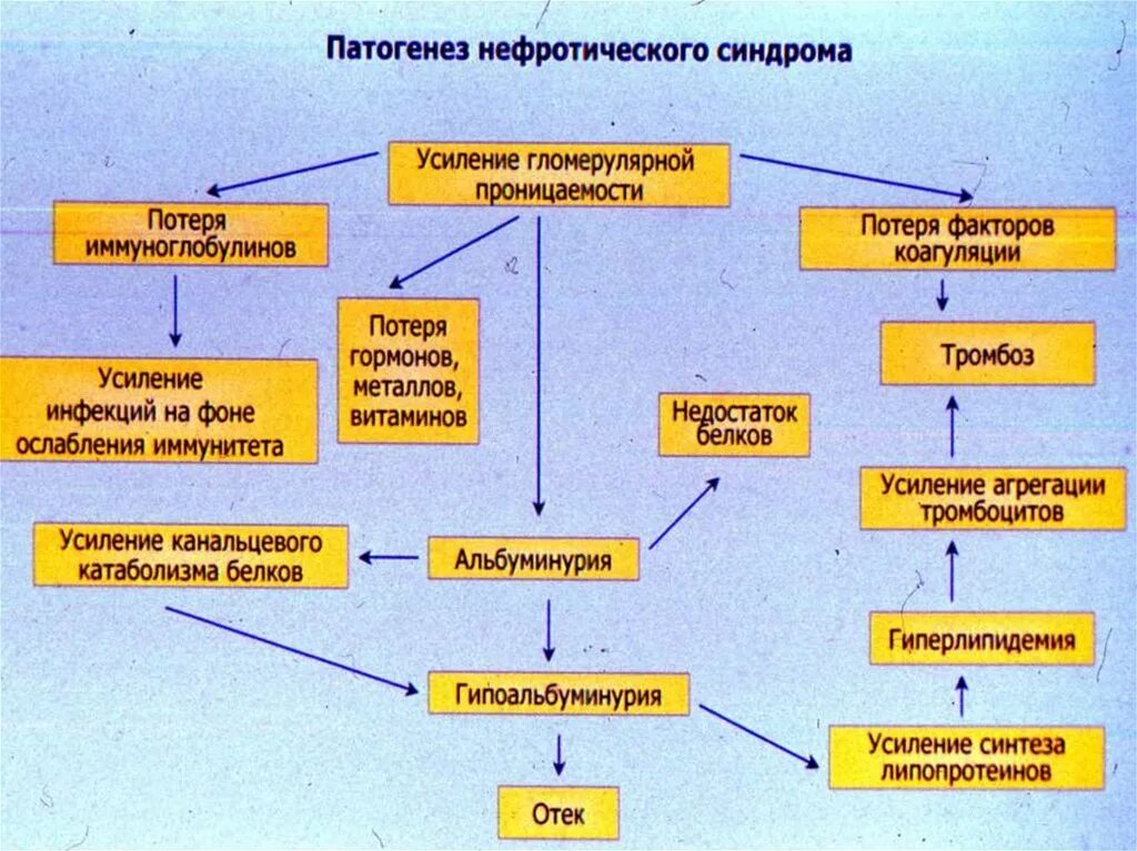 Механизм развития синдрома. Схема патогенеза клинических проявлений нефротического синдрома. патогенез при нефротическом синдроме. нефротический синдром механизм отеков. нефротический синдром патогенез патогенез.