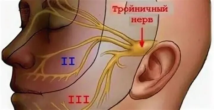 Иглоукалывание лицевой нерв. Иглоукалывание тройничный нерв. Воспаление тройничкового нерва. Невралгия тройного нерва.