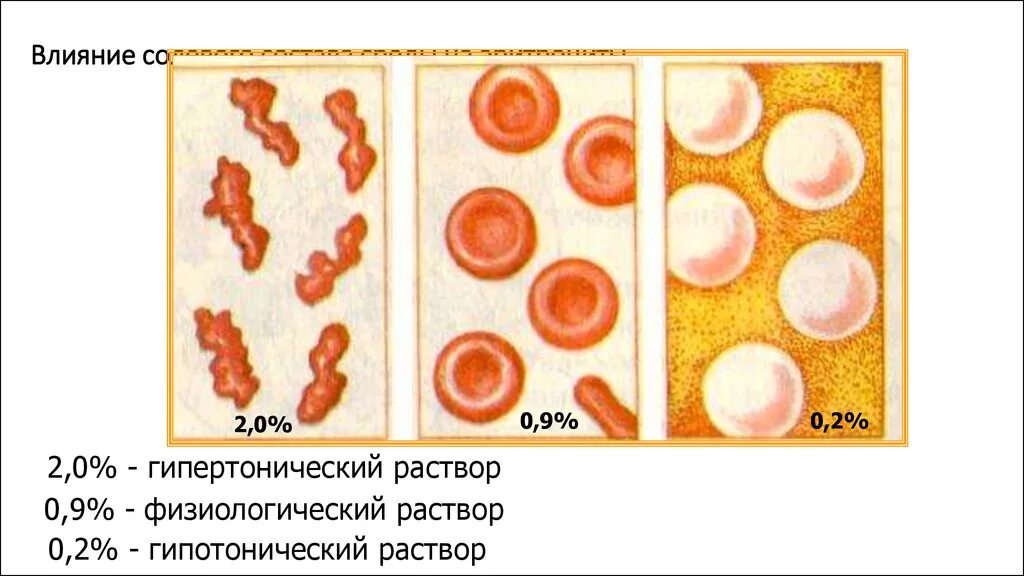 Эритроцит в гипотоническом и гипертоническом растворе. Клетки крови в гипотоническом растворе. Гипертонический раствор физиологический раствор гипотонический. Клетка в гипотоническом растворе. Эритроциты в растворе хлорида натрия